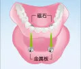 デンチャー用マグネット